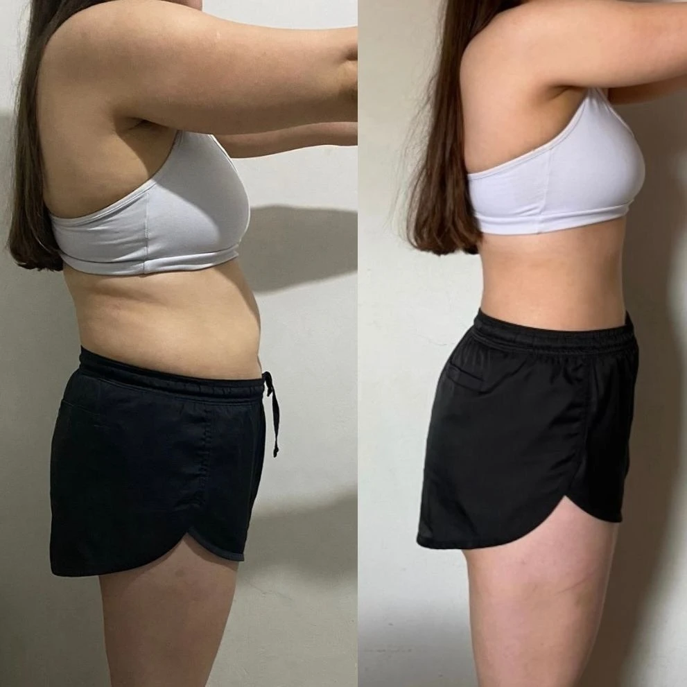 Antes e depois de aluna, de perfil
